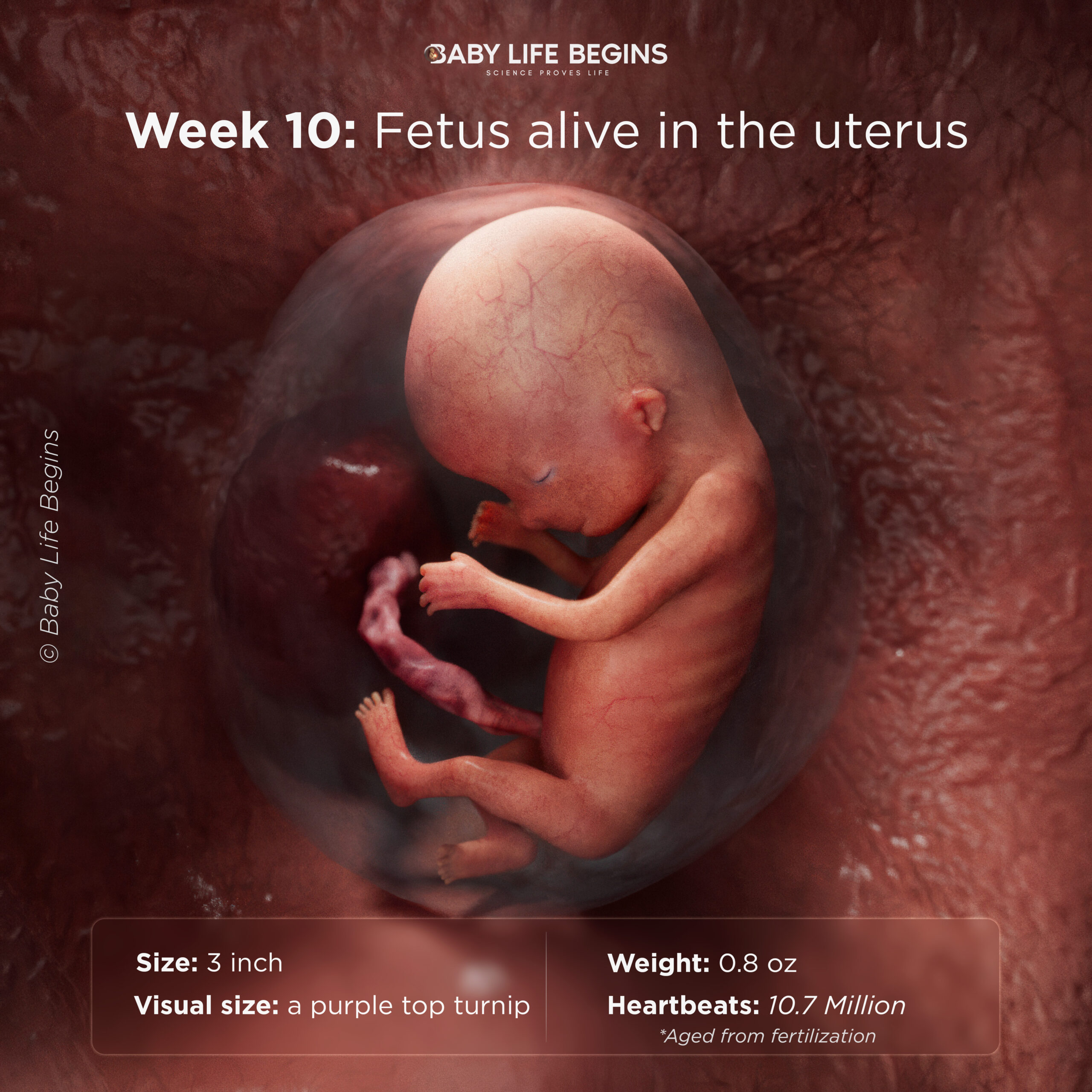 Week 10: The Baby Can Bend Arms and Legs